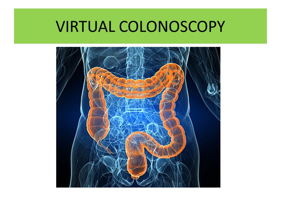 Virtual Colonoscopy